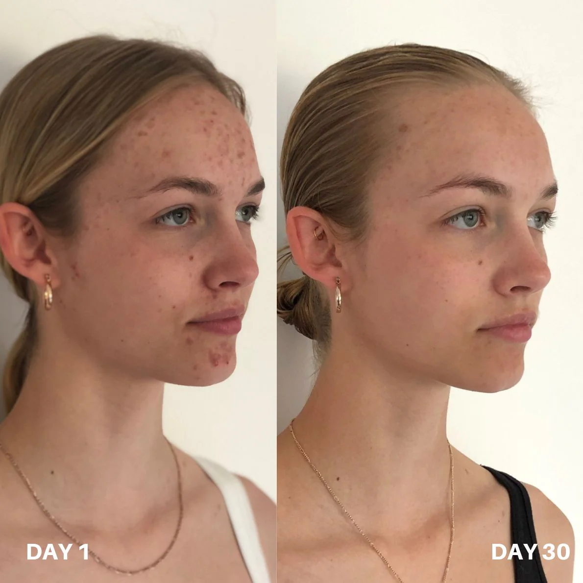 Clinisoothe+ Skin Purifier 250ML - Image 6