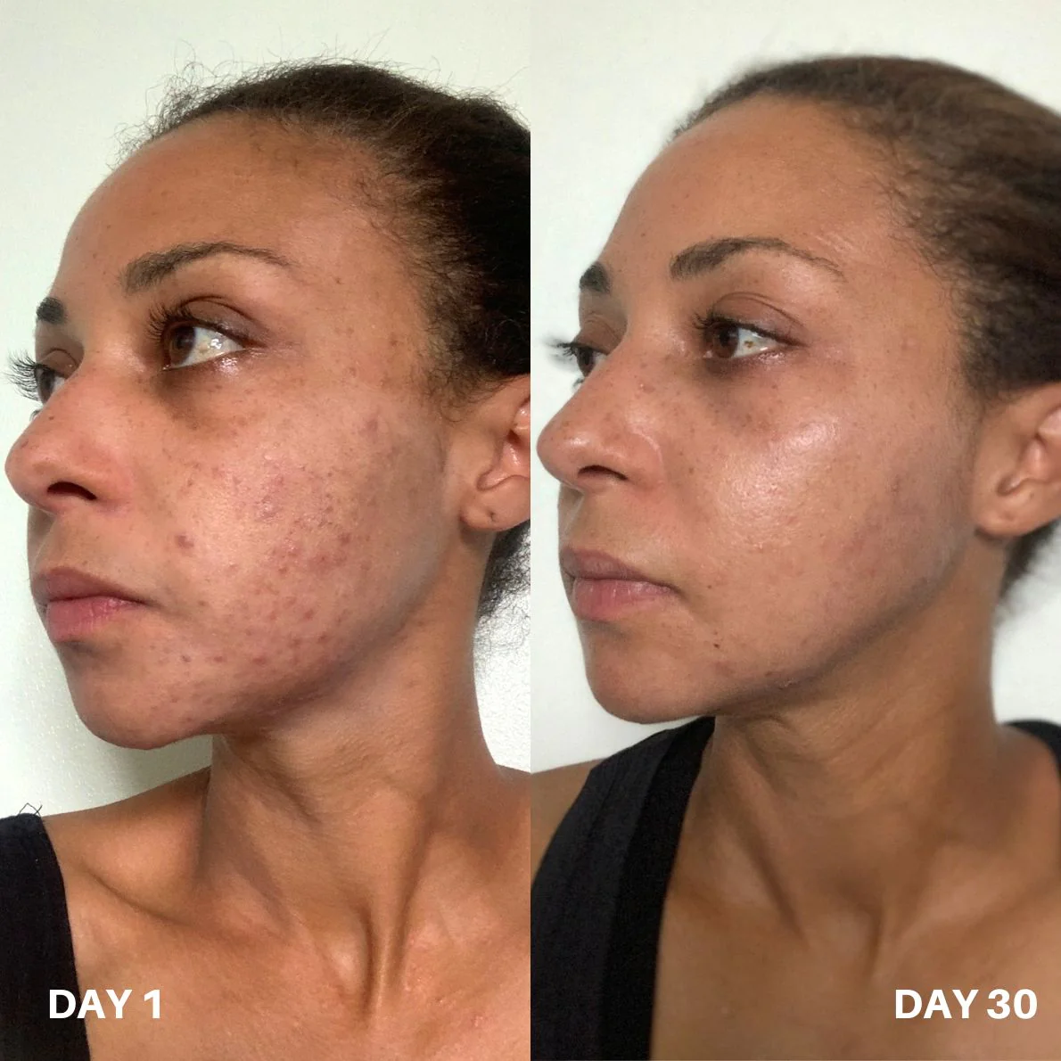 Clinisoothe+ Skin Purifier 250ML - Image 7