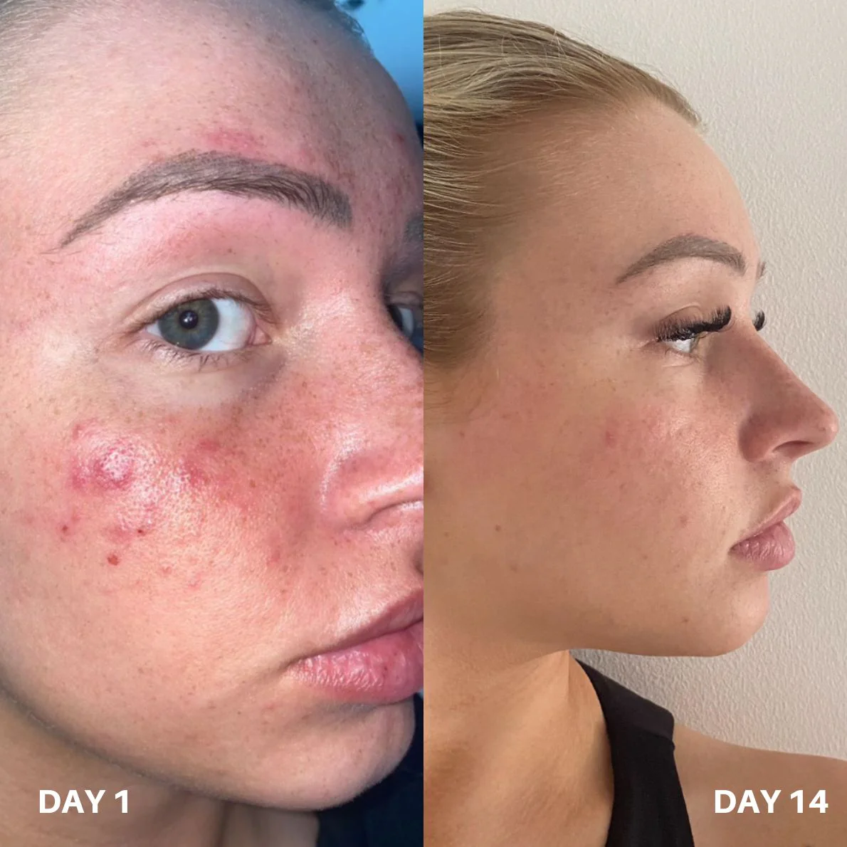 Clinisoothe+ Skin Purifier 100ML - Image 8